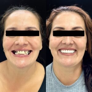 Facetune_10-03-2023-22-00-26_Original_Original