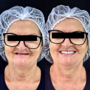veia_dr_hugo_souza_02